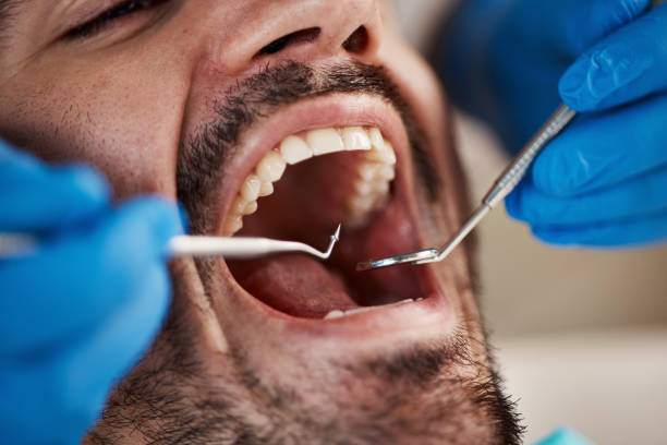 Best Pediatric Emergency Dentist in Golden Glades, FL